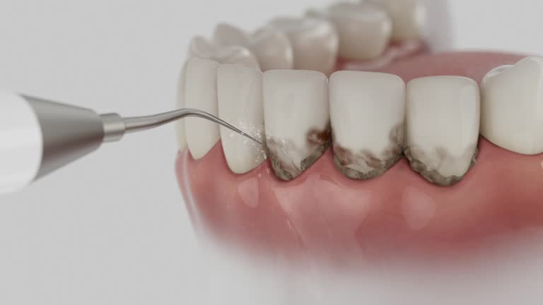 Trusted Dental Implants service in Rockwood, MI - Dentist Open Now